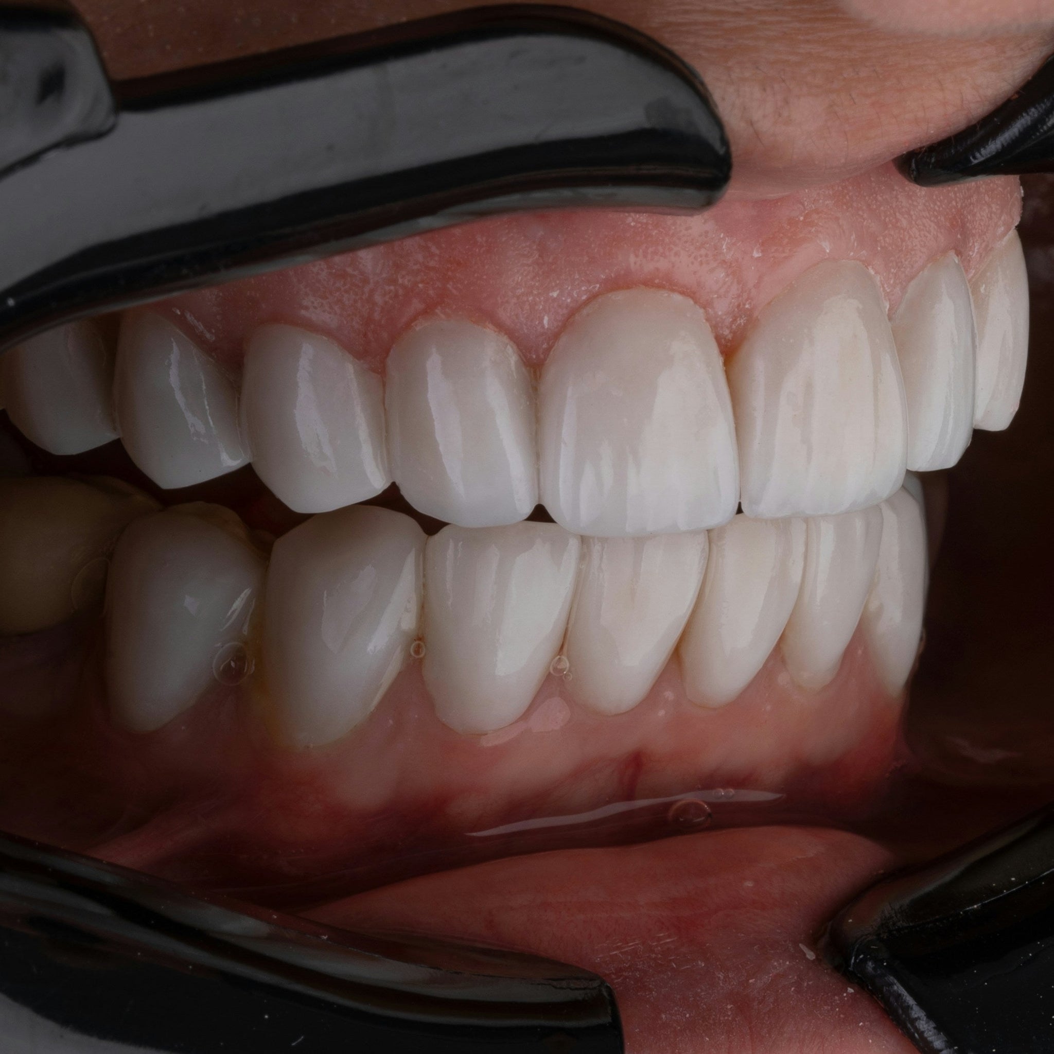The Problem with Your Current Toothpaste
